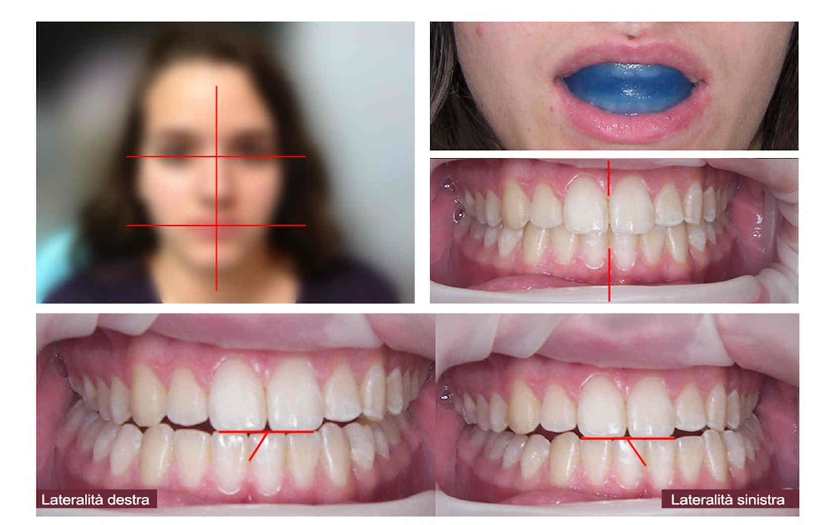 NEURO-OCCLUSAL REHABILITATION 